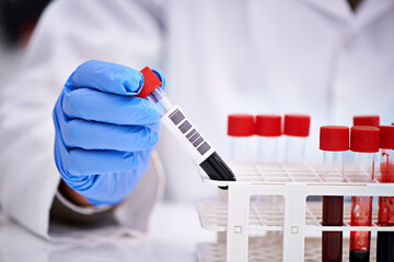 Blood test, hand and scientist in laboratory for research, studying and monkeypox virus, infection...