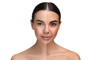 Collage with photos of beautiful young woman before and after solarium tanning on white background