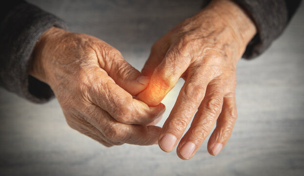 Caucasian elderly woman suffering from finger pain.