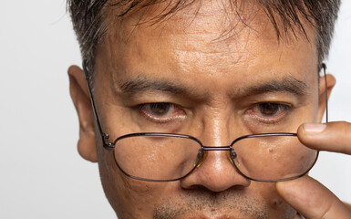 Senior man eye strain after for long stretches at computer or digital screens.