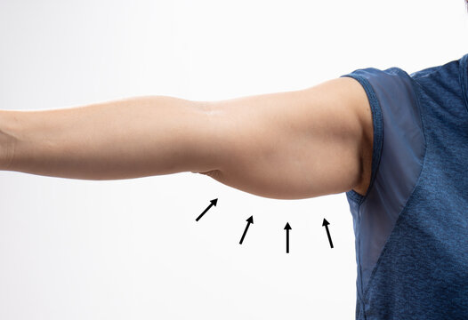 The flabbiness and wrinkled of senior woman arm skin.