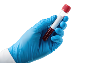A healthcare professional holds a blood sample in a laboratory setting while wearing protective gloves during testing procedures