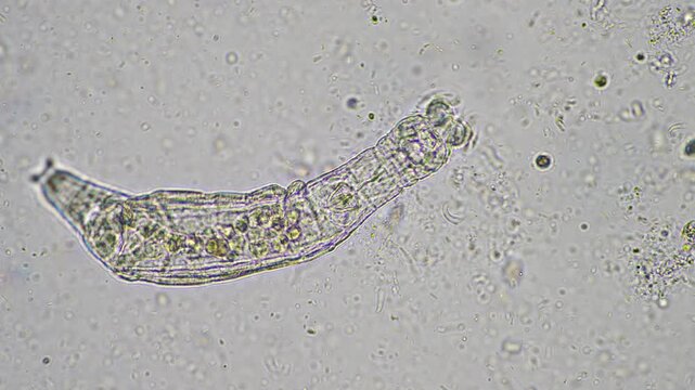 agronomist with a soil sample with soil life and bugs. microorganisms storing carbon with fungi and bacteria from a farm