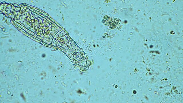 agronomist with a soil sample with soil life and bugs. microorganisms storing carbon with fungi and bacteria from a farm