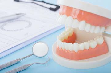 歯の模型と歯科治療のイメージ