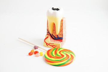 Tooth decay with sweet sugar candy, bad food for dental health care.