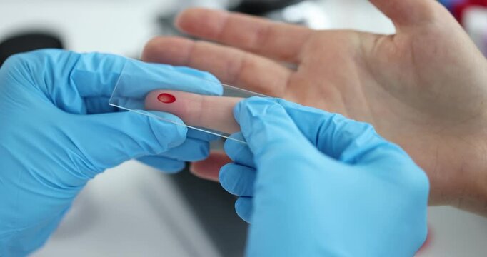 Doctor takes blood from finger for analysis. Complete blood count and biochemical concept