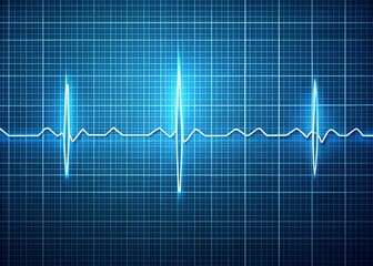 Naklejka premium A realistic illustration of an ECG waveform displaying a left bundle branch block pattern with a subtle grid background and clear annotations