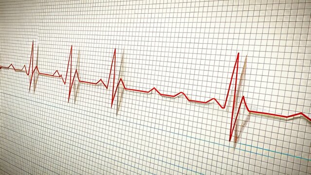 A stylized illustration of ECG limb leads on a clean white background with a subtle grid pattern, featuring bright and accurate colors, precise lines