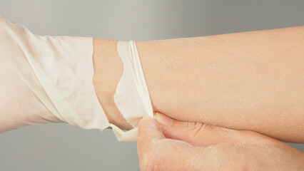 Hand Wearing torn or leak latex glove on gray background.