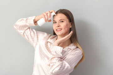 Young woman with acne problem and bottle of skincare product on light background