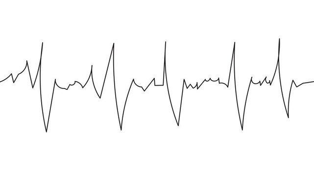 heart beat ecg or ekg animation on white background video