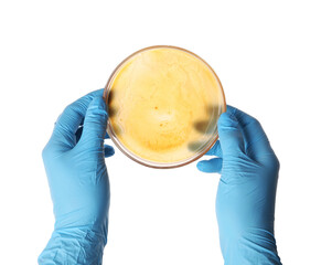 Laboratory worker holding petri dish with bacteria on white background, closeup