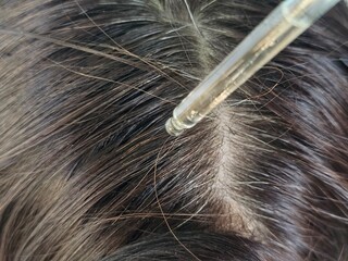 Closeup of product being applied to scalp using pipette on healthy hair concept