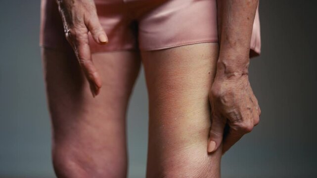 Close-up of senior woman massaging dry leg skin, muscle cramps, healthcare
