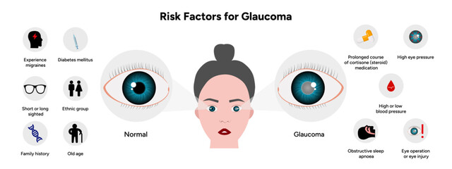 Risk factors for glaucoma disease Optometry