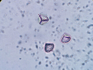 photo of archegonia spores under the microscope 