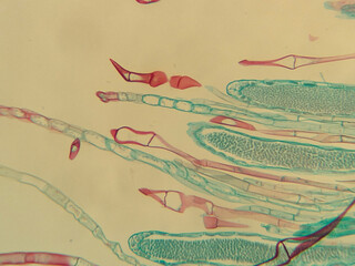 Microscope Slide Images Showcasing Biological Specimens