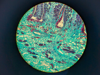 photo of archegonium tissue under the microscope