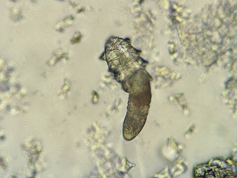 photo of demodex face mite under the microscope