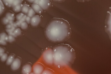 Bacterial colonies growing on agar plate.