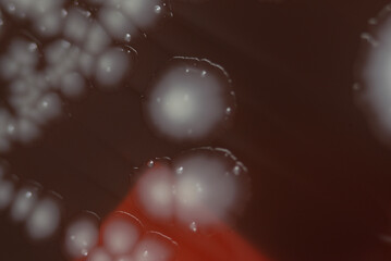Bacterial colonies growing on agar plate.