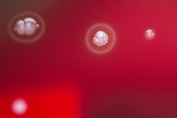 Bacterial colonies growing on agar plate.