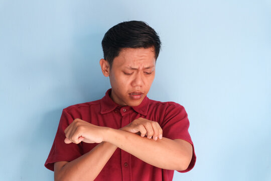 Young Asian man scratching his hand and showing uncomfortable expression