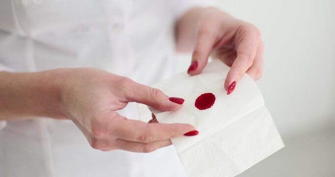 Woman hands hold napkin with red blood closeup. Early periods and causes