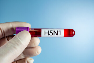 Blood collection tubes H5N1 bird flu test positive results,Medical health concept