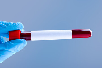 Laboratory worker holding test tube with blood sample and blank label on grey background, closeup....