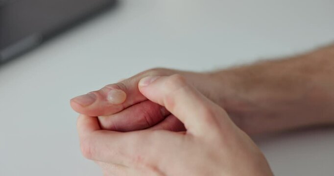 Hands, boil and dermatology with swelling, person and inflammation with fat cell accumulation. Closeup, fingers and pain with atheroma examination, treatment and sebaceous cyst with furunculosis