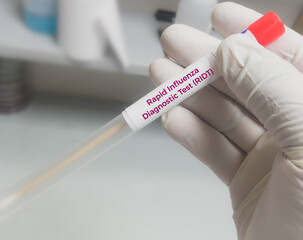 Swab Sample for H1N1Flu (swine flu) test. Influenza virus. Rapid Influenza Antigen.