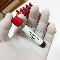 Blood sample for Oropouche virus Test to diagnosis of Oropouche virus disease or  Oropouche fever....