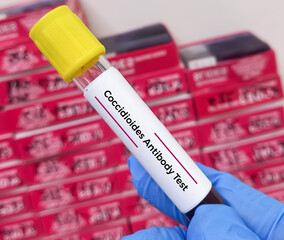 Coccidioides Antibody test. Coccidioidomycosis, fungal disease, Valley fever, California fever.