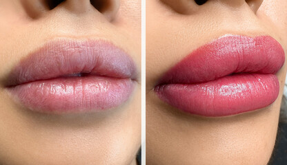 permanent makeup on the lips of a young woman of a delicate peach shade close-up, a girl after a...