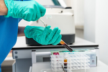 Lab tech preparing medical samples. A technician in gloves carefully transfers a liquid sample using a pipette