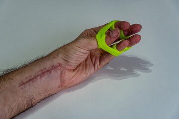 recovery of a hand injuried