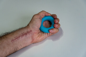 recovery of a hand injuried