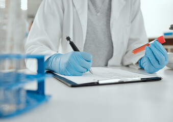 Laboratory, person and test tube with clipboard for writing, medicine information and notes for...