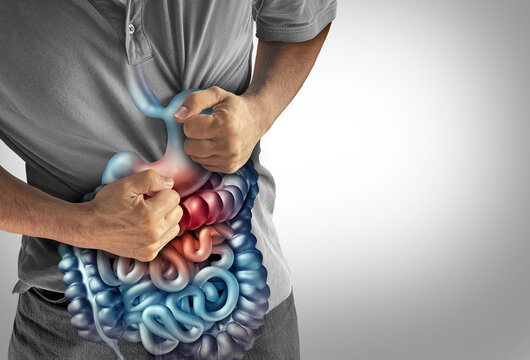 IBS Symptoms and Stomach Pains or stomachache with a painful digestive system ache as an abdominal illness or irritable bowel syndrome and Ulcers as intestinal inflammation or bloating
