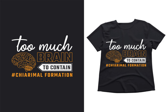 Too much brain to contain, brain shirt, Chiari shirt, Chiari malformation shirt, ACM awareness, zipperhead shirt, purple awareness