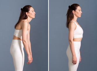 Woman slouching and with correct posture. Comparison