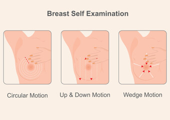 The three methods to perform a breast self-examination