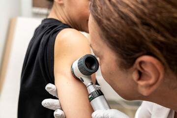 dermatologist examines birthmarks on the patient's skin with a dermatoscope. Dermatology, skin mole...