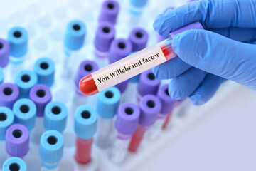 Doctor holding a test blood sample tube with Von Willebrand Factor Test on the background of...