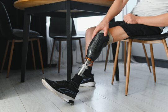 portrait of man with prosthetic leg sitting
