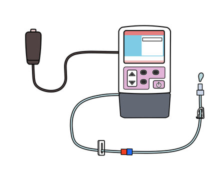 PCAポンプ（機械式）