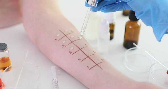 Demonstration of allergy skin test procedure