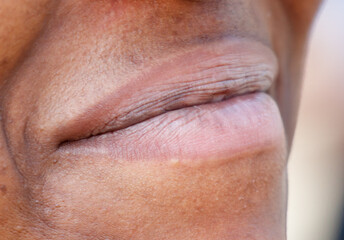 A woman's face with a wrinkled lip